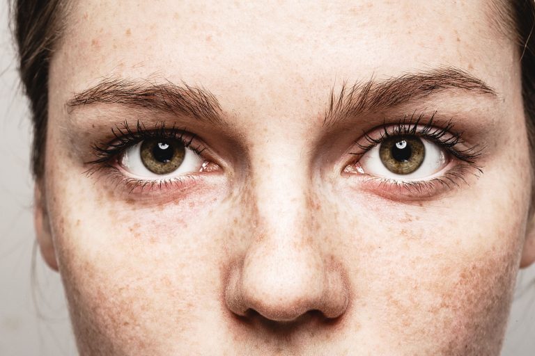 Big hazel eyes in a freckled face